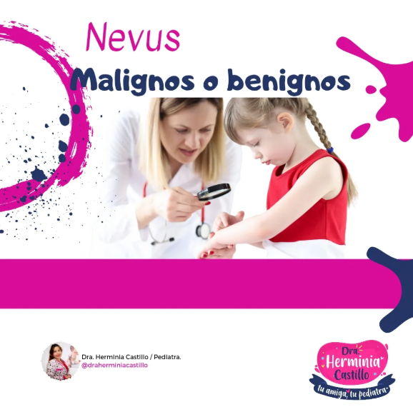Nevus malignos o benignos